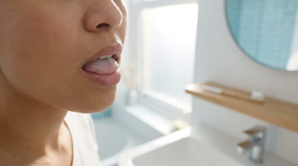 Gros plan sur une personne examinant sa langue blanche devant le miroir d'une salle de bain.